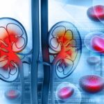 Understanding the 5 Stages of Chronic Kidney Disease
