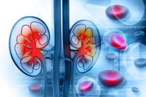 Understanding the 5 Stages of Chronic Kidney Disease